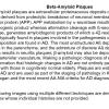 0A Beta-Amyloid Plaques - Text