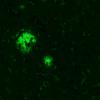 4C5 AD Amyloid Thioflavin S 3 copy