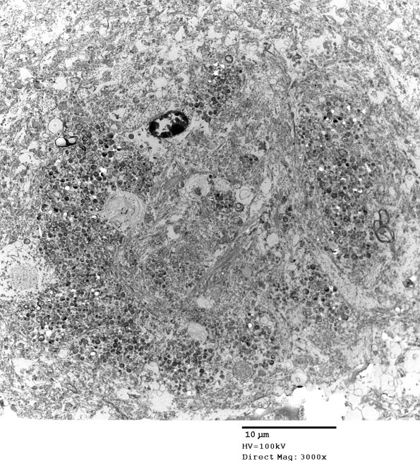 4H1 AD Ultrastructure EM 054 - Copy