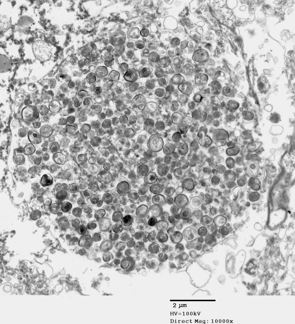 4H5 AD Ultrastructure EM 083 - Copy