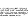 6A0 Amyloid Angiopathy (Congophilic Angiopathy) - Text