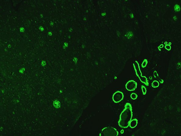 6C1 AD amyloid Thio-S 3