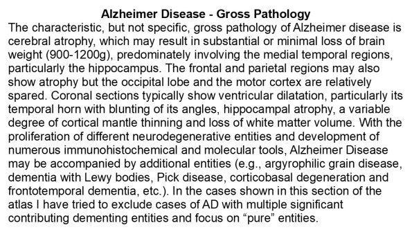 0A Alzheimer Disease - Gross Pathology - Text