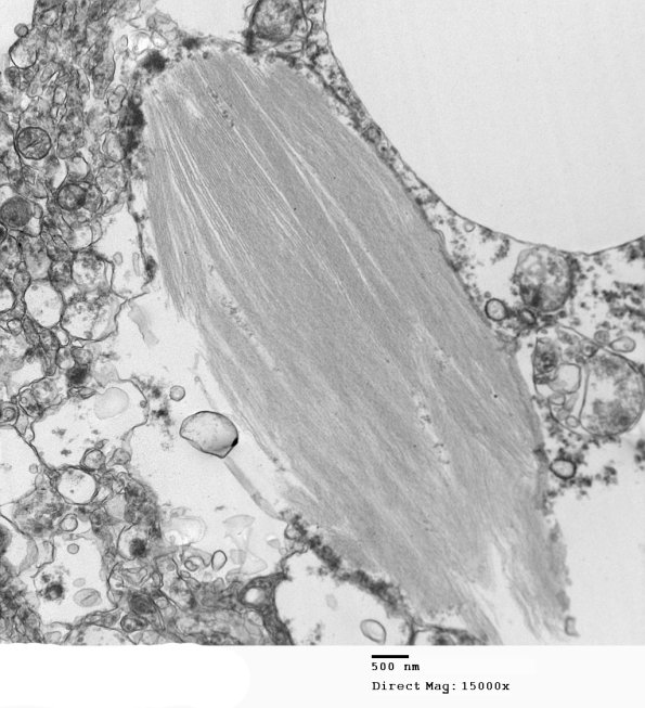 1C20 AD (Case 1) Hirano EM 073 - Copy