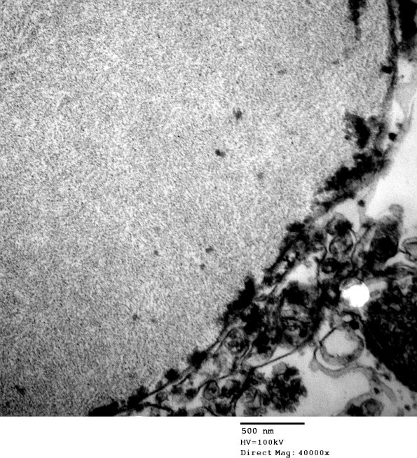 2D2 AD (Case 2) Ultrastructure EM 030 - Copy