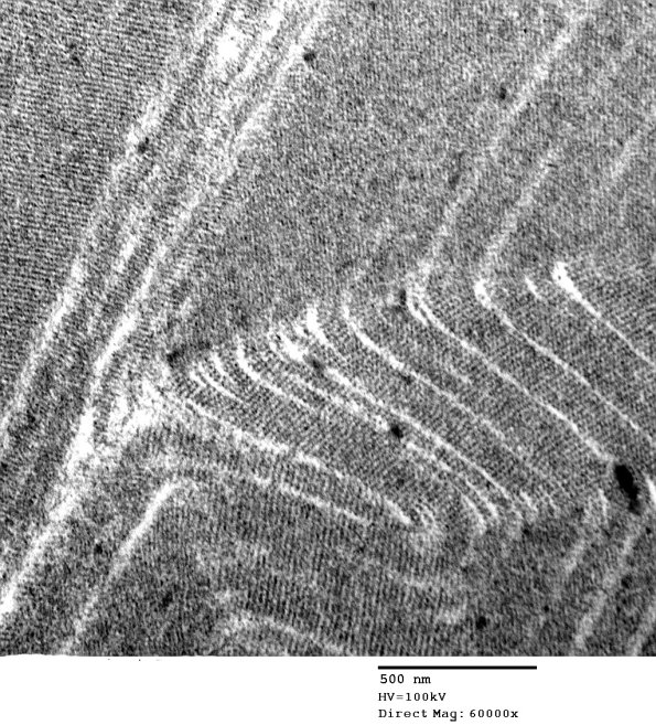 2D5 AD (Case 2) Ultrastructure EM 036 - Copy