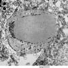 2D7 AD (Case 2) Ultrastructure EM 038 - Copy