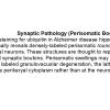 0A Synaptic Pathology - Text