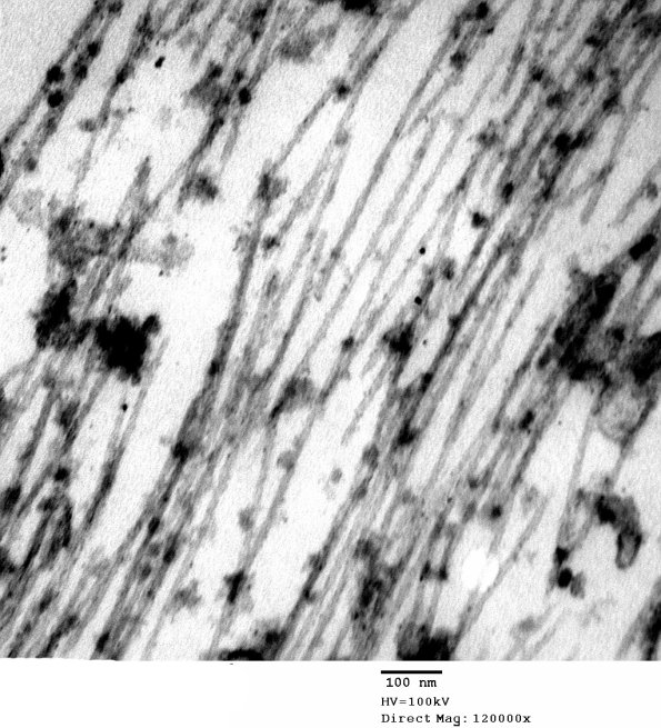 6A7 AD Ultrastructure EM 066 - Copy