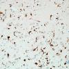 1F2-Anti-NMDAR-Hu-CRMP5-Case-1-N2-CD68-4.jpg