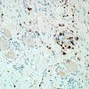 1H7-Anti-NMDAR-Case-1-N19-CD3-19.jpg