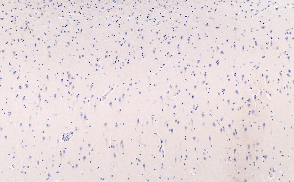 1F1 Argyrophilic Grain Dz (AGD, Case 1) L23 BAP 10X