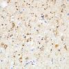 3A4 Argyrophilic Grain Dementia (Case 3) L23 PHF 10.jpg