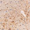 3B2 Argyrophilic Grain Dementia (Case 3) L5 PHF 40X 3