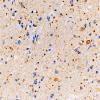 3B3 Argyrophilic Grain Dementia (Case 3) L5 PHF 20X