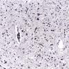 3C1 Argyrophilic Grain Dementia (Case 3) L23 Gallyas 20X