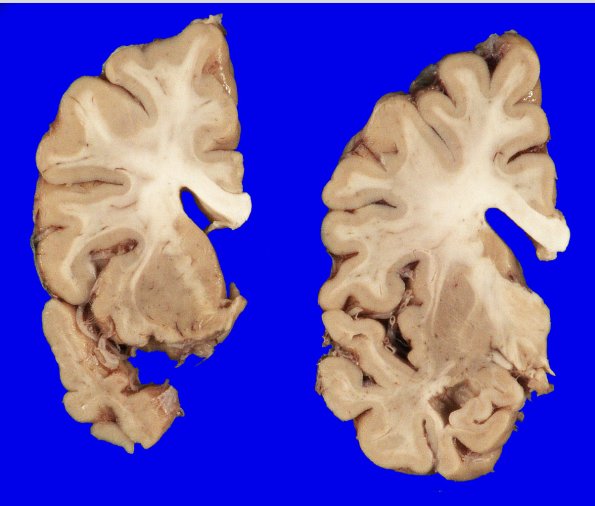 7A1 AGD (Case 7) Gross_1