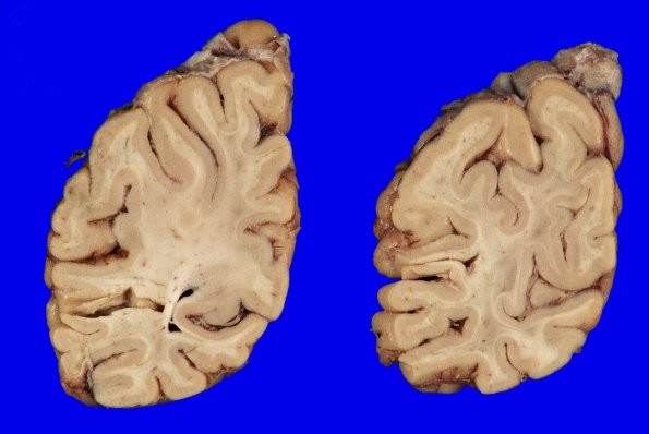 7A3 AGD (Case 7) Gross_3