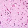 1B7 Corticobasal Degeneration (Case 1) H&E 1.jpg