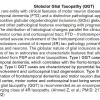 0A Globular Glial Tauopathy - Text