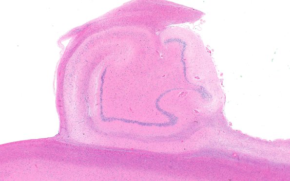 7B2 HS no AD (A41273) H&E 2X