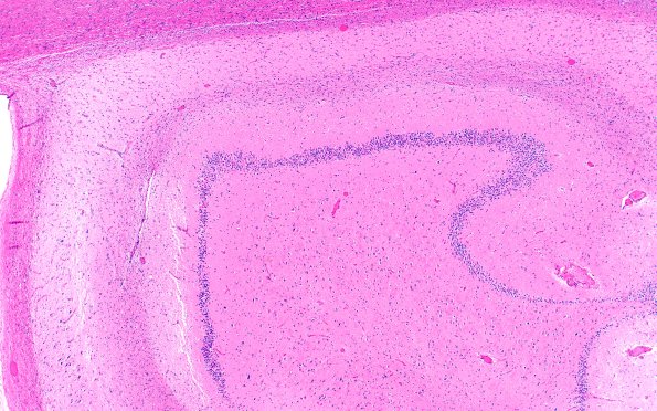 7B3 HS no AD (A41273) H&E 4X