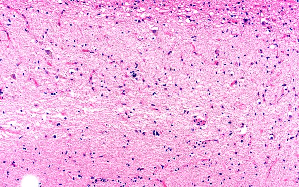 7B5 HS no AD (A41273) H&E 20X