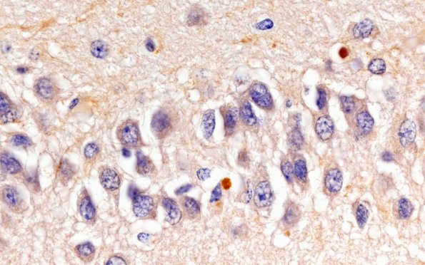 7C1 HS no AD (A41273) TDP43 100X 3