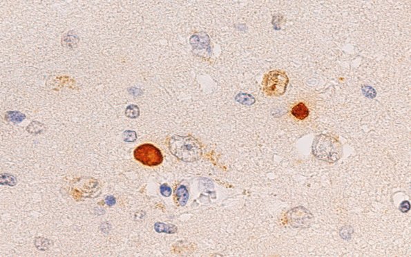 8F3 HD (Case 8) L6 1C2 put 1C2 100X