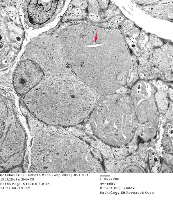 3B1 Kotzbauer iPLA2Beta Mice (Aug 2007)_051 SMG-CG copy - Copy