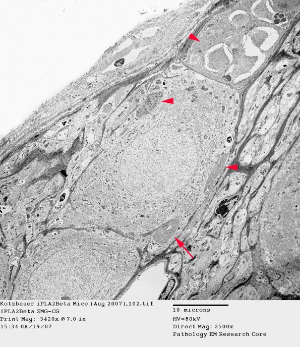 3B3 Kotzbauer iPLA2Beta Mice (Aug 2007)_102 SMG-CG copy - Copy