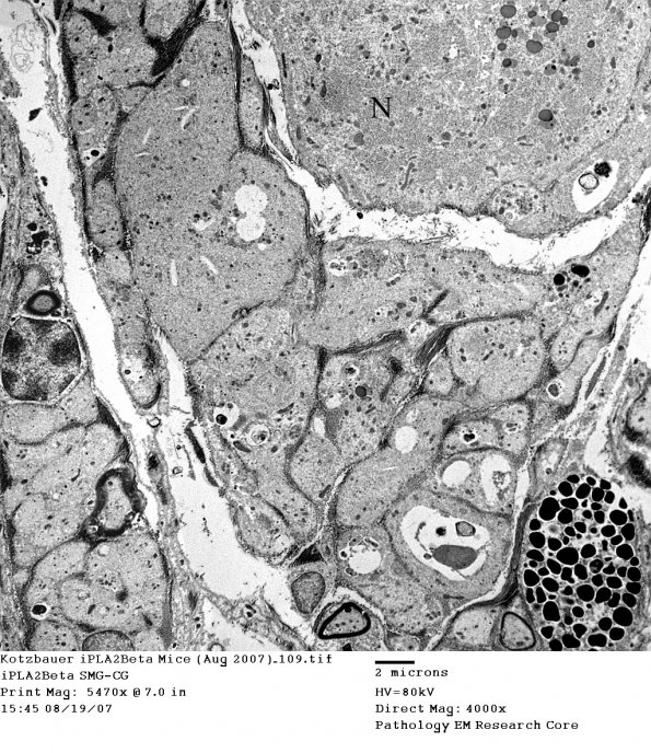 3B5 Kotzbauer iPLA2Beta Mice (Aug 2007)_109 SMG-CG copy - Copy