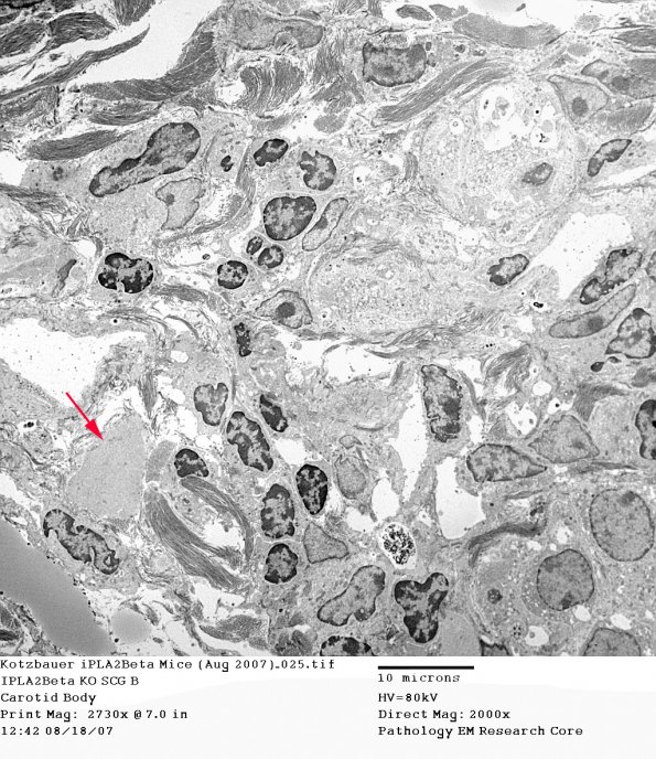 3C Kotzbauer iPLA2Beta Mice (Aug 2007)_025 copy - Copy