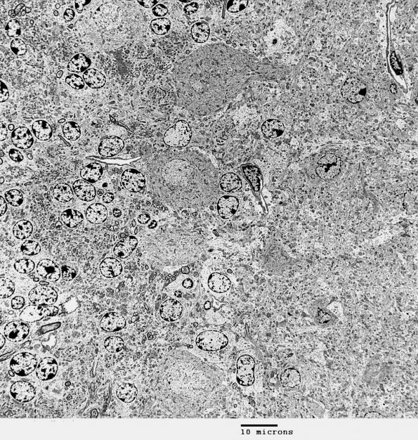 3D1 Cerebellum, normal mouse, EM (Kotzbauer exp) 1 - Copy