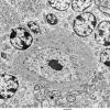 3D2 Cerebellum, normal mouse, EM (Kotzbauer exp) 2 - Copy