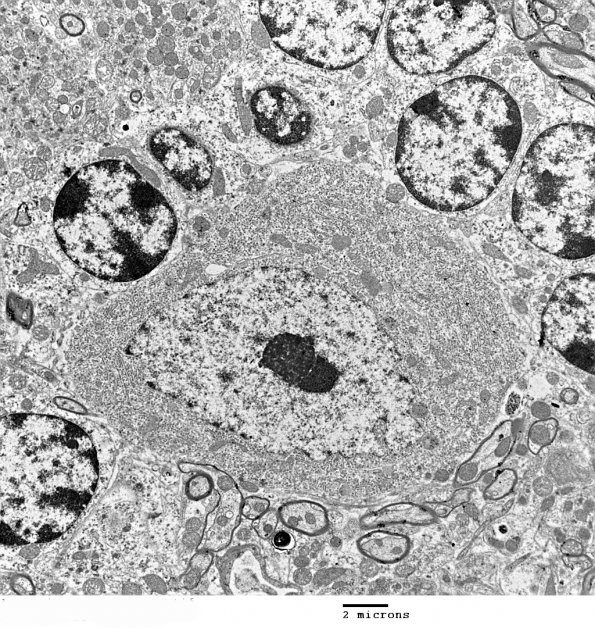 3D2 Cerebellum, normal mouse, EM (Kotzbauer exp) 2 - Copy