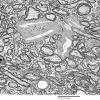 3D4 iPLA2beta KO Cerebellum Dystrophy (06-212H) EM 10 - Copy