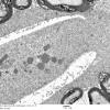 3D5 iPLA2beta KO Cerebellum Dystrophy (06-212H) EM 11 - Copy