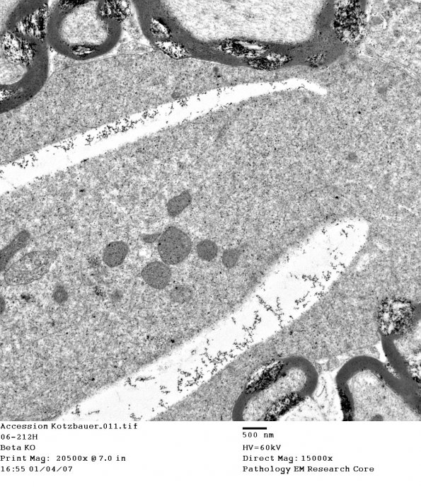 3D5 iPLA2beta KO Cerebellum Dystrophy (06-212H) EM 11 - Copy