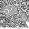 3D6 iPLA2beta KO Cerebellum Dystrophy (06-212H) EM 12 - Copy