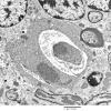 3D7 iPLA2beta KO Cerebellum Dystrophy (06-212H) EM 14 - Copy