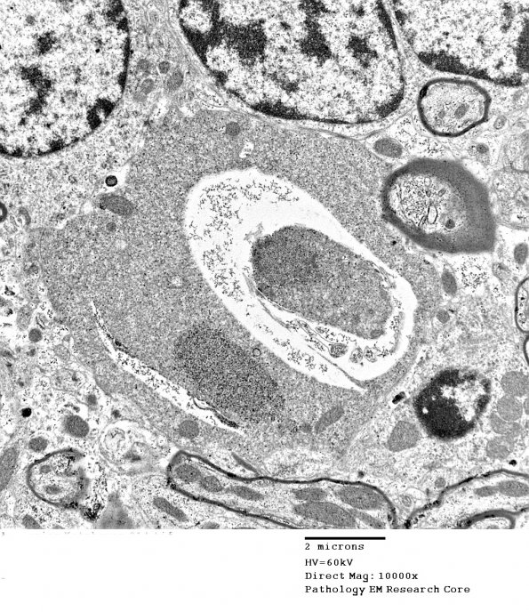 3D7 iPLA2beta KO Cerebellum Dystrophy (06-212H) EM 14 - Copy