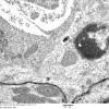 3D8 iPLA2beta KO Cerebellum Dystrophy (06-212H) EM 15 - Copy