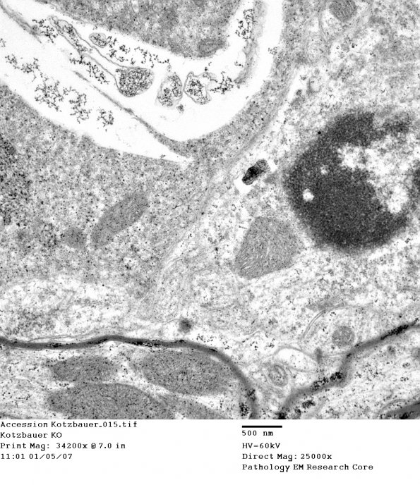 3D8 iPLA2beta KO Cerebellum Dystrophy (06-212H) EM 15 - Copy