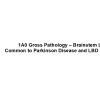 1A0 Gross Pathology – Brainstem LBD