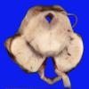 1A1 Brainstem, normal (Case 1) Gross _2