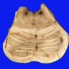 1A2 Brainstem, normal (Case 1) Gross _3