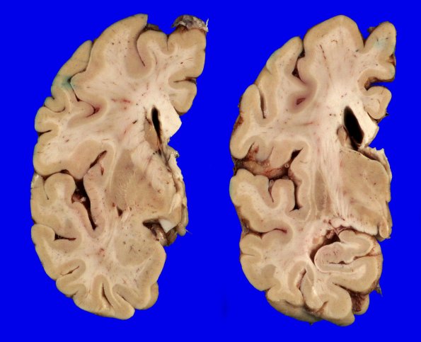 8A4 DLBD (Case 8) _3