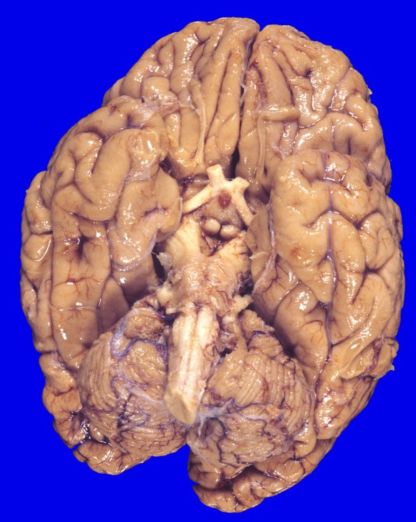 10A1 MSA (Case 10) 5