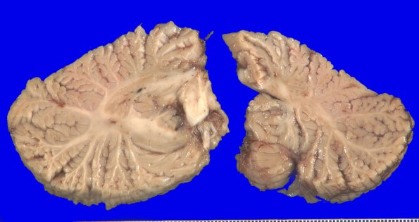 12A4 MSA (Case 12) _3